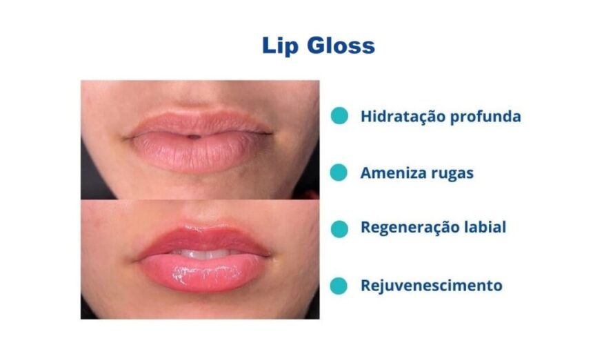 Clínica Dermostética: Lip Gloss